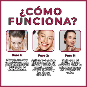 Serum Anti acné®